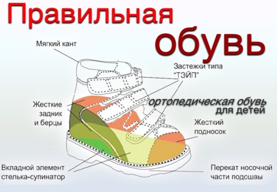 Правила выбора обуви при плоскостопии