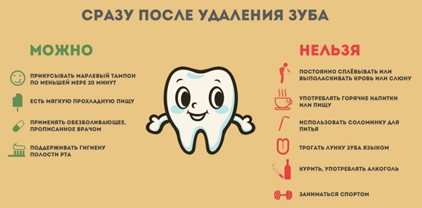 Несколько рекомендаций после удаления зуба